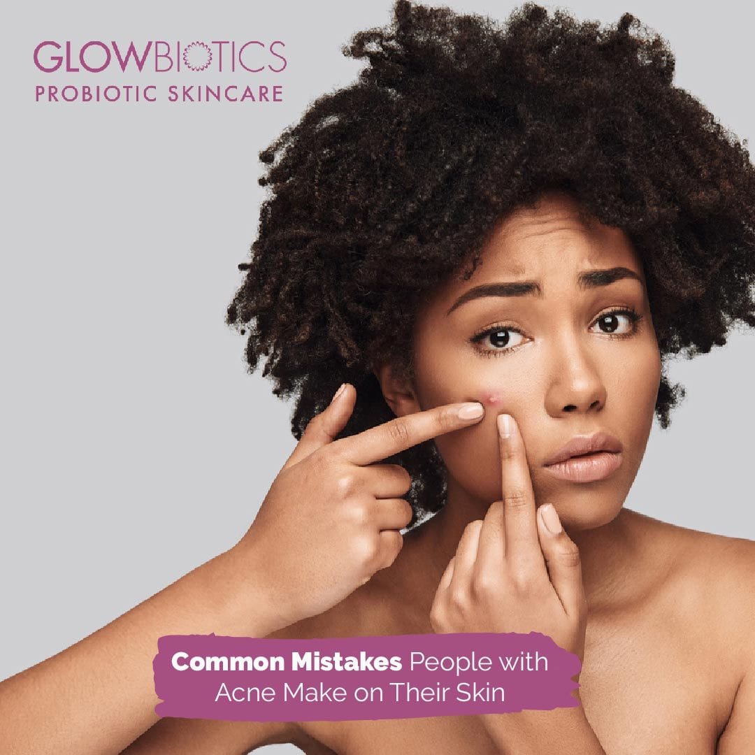 Common Mistakes People with Acne Make on Their Skin