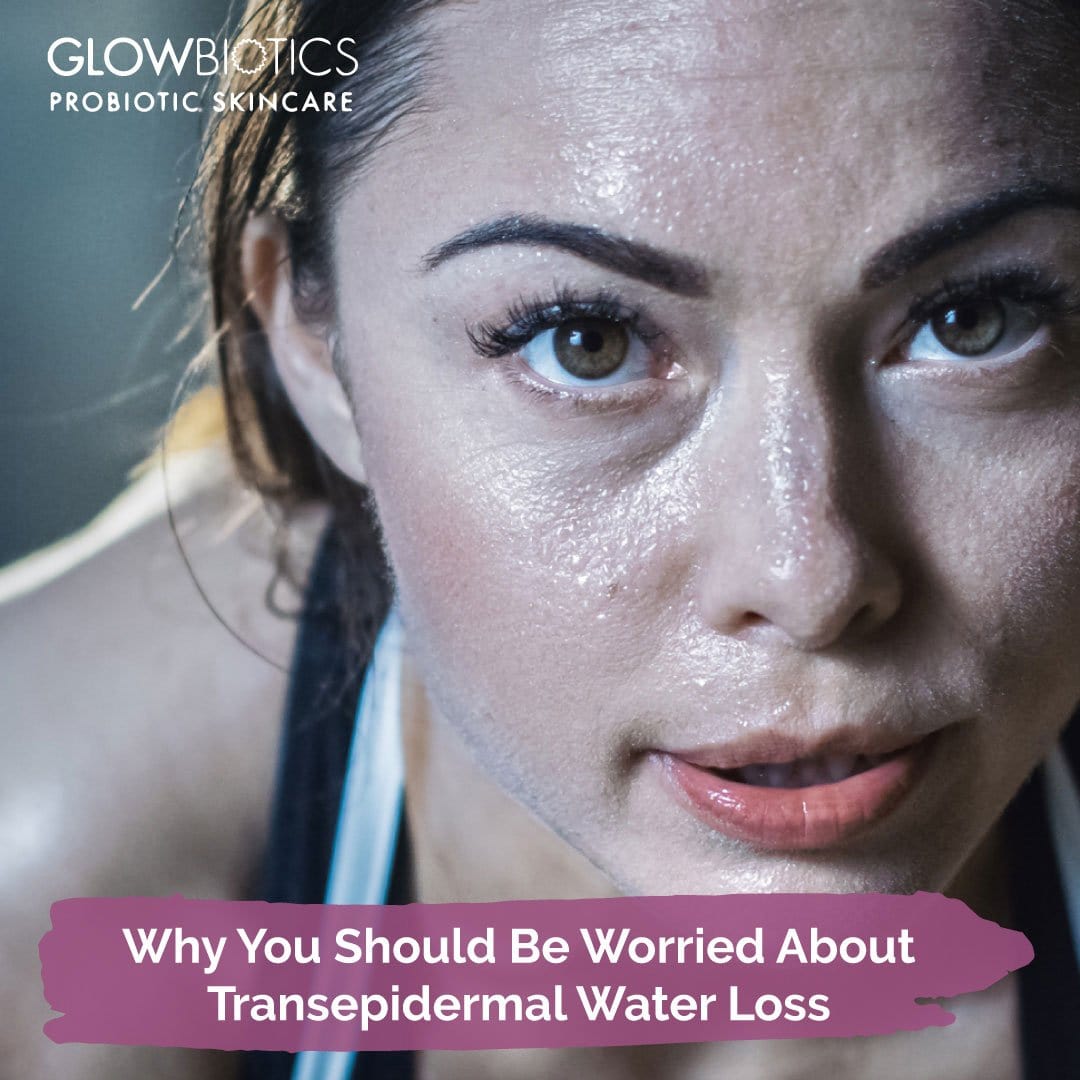Why You Should Be Worried About Transepidermal Water Loss