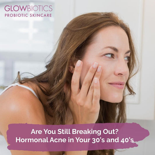 Are You Still Breaking Out? Hormonal Acne in Your 30's and 40's