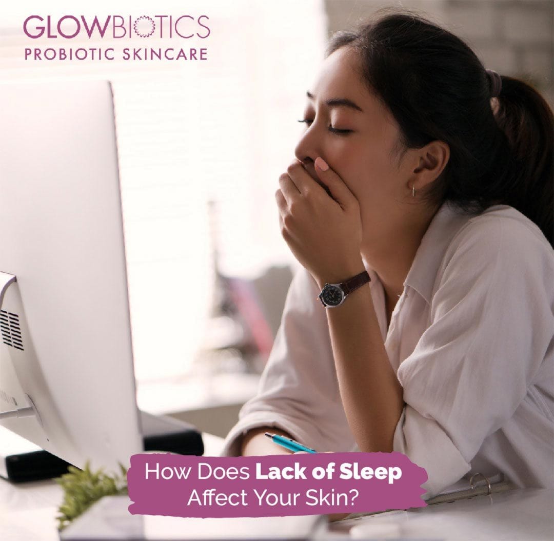 How Does Lack of Sleep Affect Your Skin?