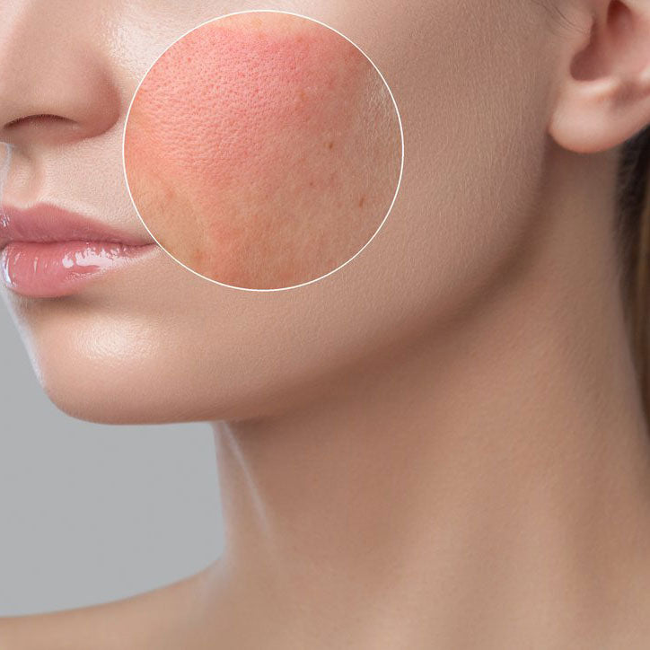 Why Your Skin is Misbehaving