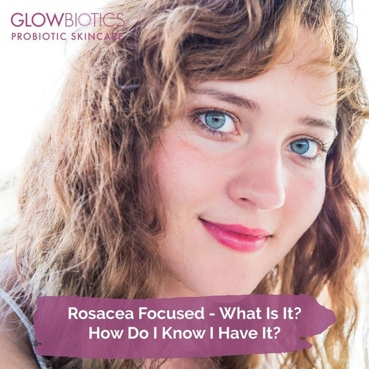 Rosacea Focused - What Is It? How Do I Know I Have It?