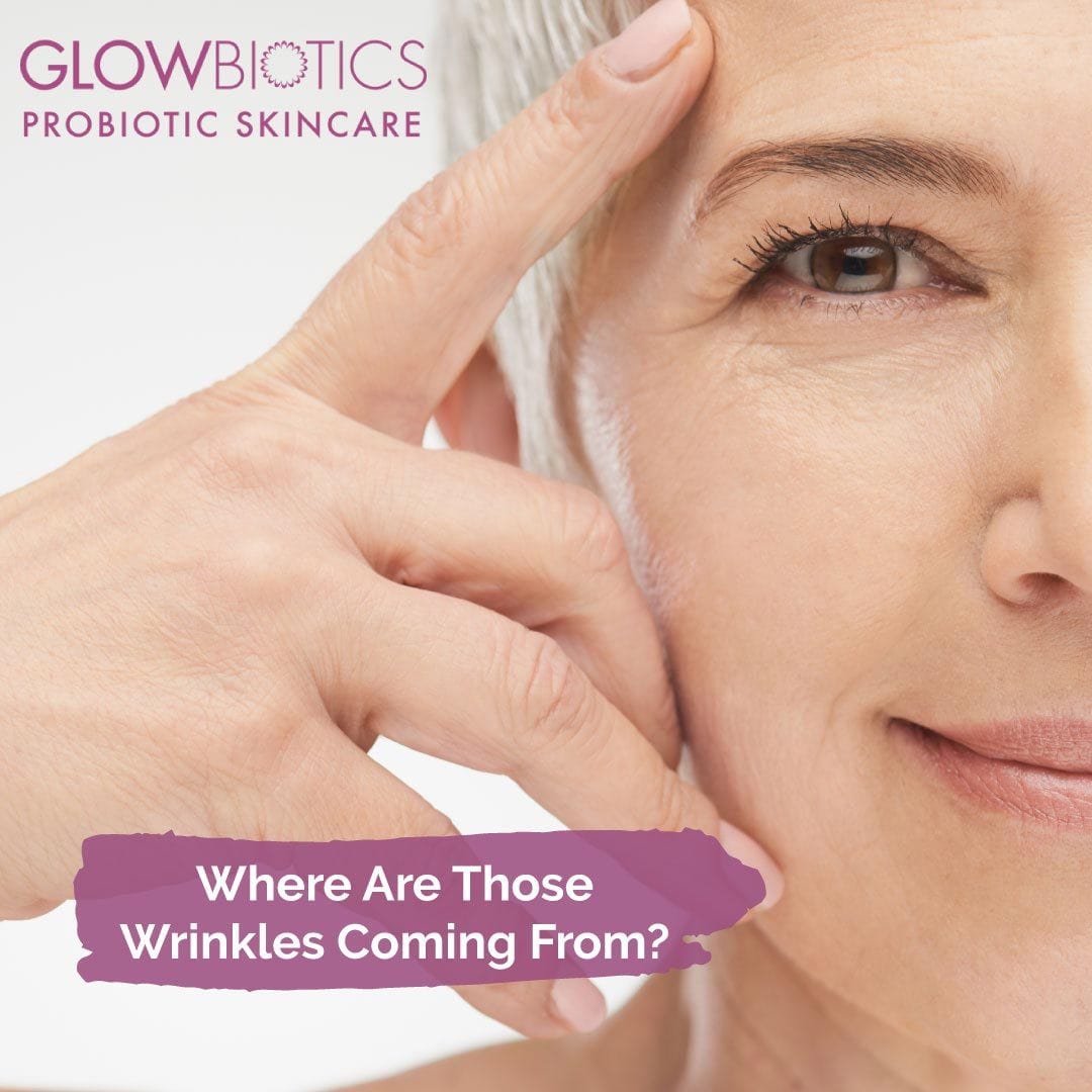 Where Are Those Wrinkles Coming From?