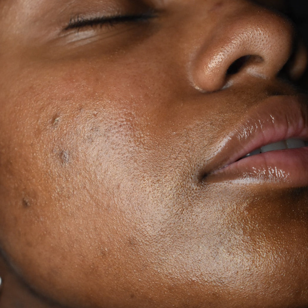 Close-up of deep-tone skin wearing Glowbiotics Bronze HydraGlow Illuminating Serum, highlighting a smooth, dewy cheek and natural radiance.