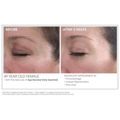Advanced Retinol Renewal Treatment