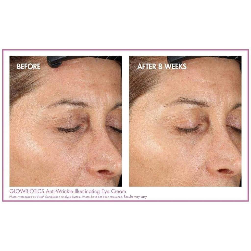 Before and after comparison of a woman’s eye area showing visible improvement after 8 weeks of use