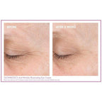 Before and after comparison of a closed-eye area showing visible improvement after 8 weeks of use