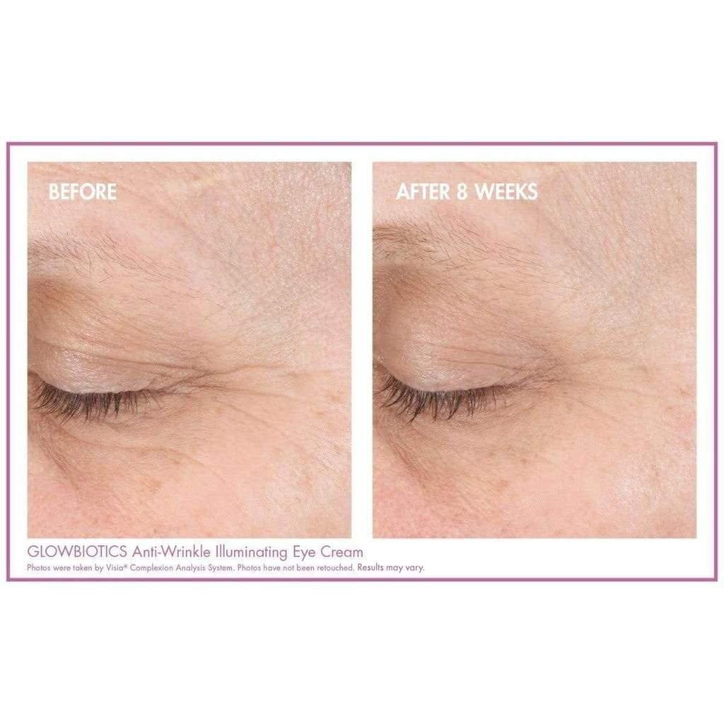 Before and after comparison of a closed-eye area showing visible improvement after 8 weeks of use